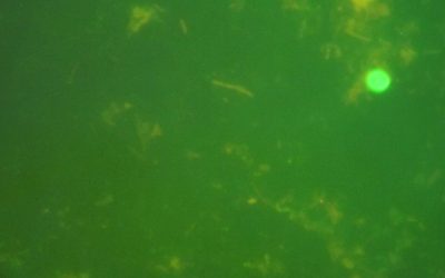 Varias ciudades españolas apuestan sistematizar los controles que permiten detectar el parásito que aparece en el agua y puede causar gastroenteritis